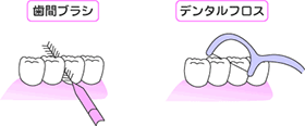 フロス等の使い方イメージ